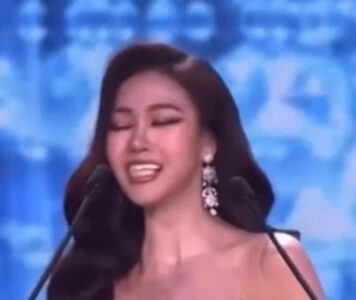 Teeth fell out on stage during the speech